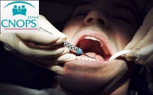 ارتفاع تكلفة علاجات طب الأسنان تقصم ظهر "الكنوبس" والمواطن
