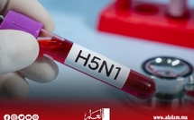 فيروس "H5N1".. سلالة جديدة من إنفلونزا الطيور تنتشر